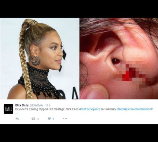 Fãs se mutilam em homenagem a Beyoncé e postam fotos na web