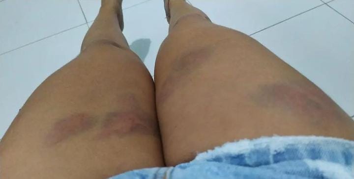 NÃO RESPEITOU: Homem pula muro de residência e espanca ex-mulher com medida protetiva 