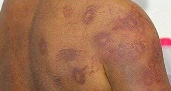 DESCONTROLADA: Esposa de 41 é presa por espancar marido de 61 anos após bebedeira 