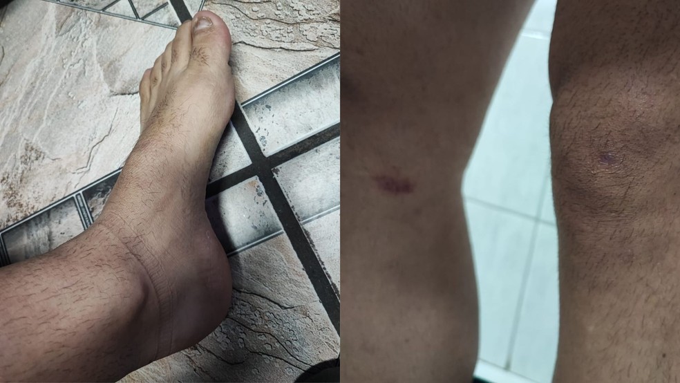 NA FISSURA: Filho invade residência, pega TV para trocar por drogas e agride o pai