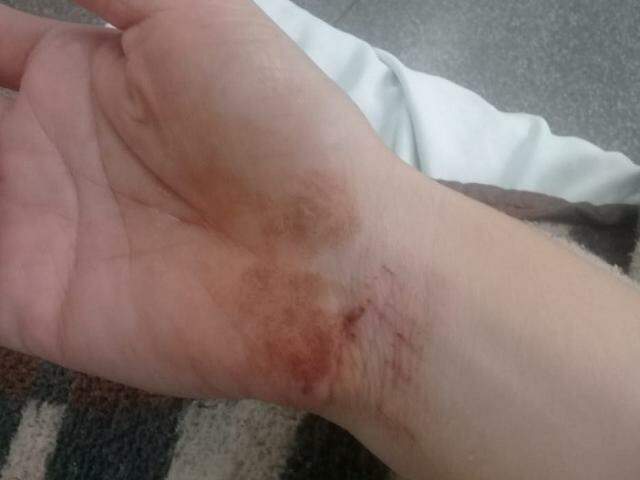 AO SAIR DO TRABALHO: Mulher é derrubada no chão e espancada por ladrões durante roubo 