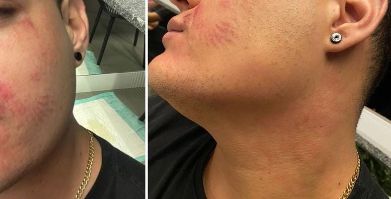 NO LIBERDADE: PM é acionada após homem levar surra do ex-namorado 