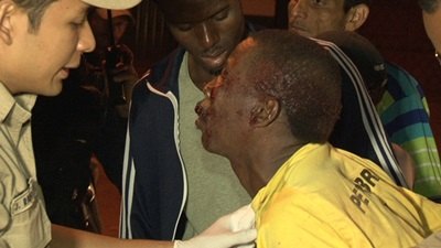 BRUTALIDADE - Haitiano é agredido a pauladas por marginais que queriam roubá-lo - FOTOS