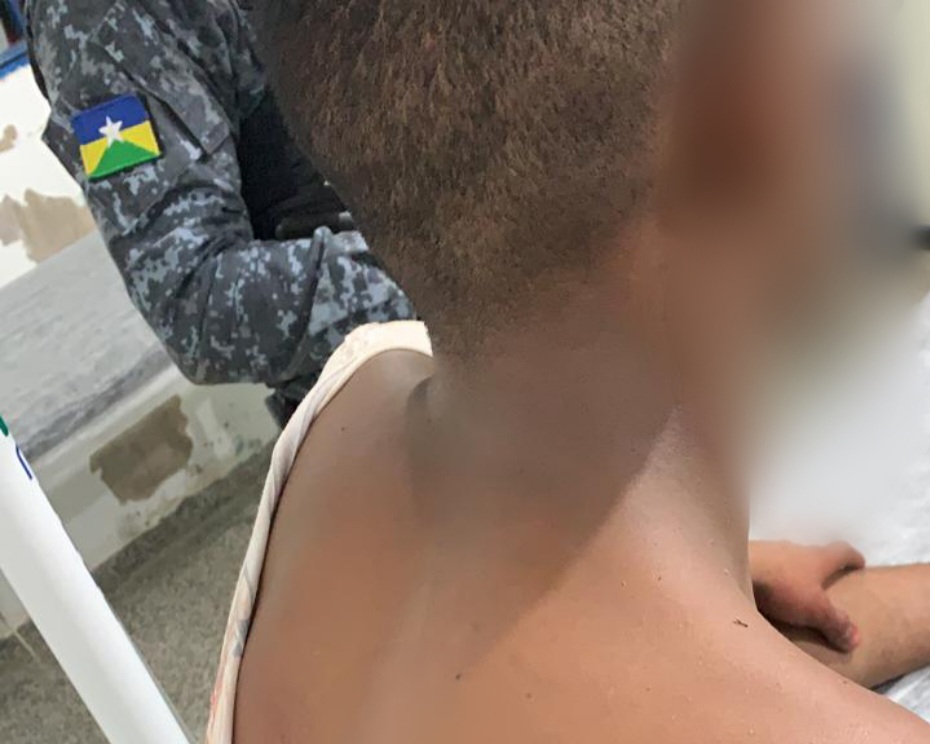 TROCA DE TIROS: Cabo da PM reage assalto e adolescente é baleado em Porto Velho