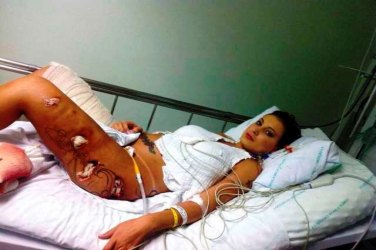 Imagens fortes: fotos de A. Urach no hospital são divulgadas