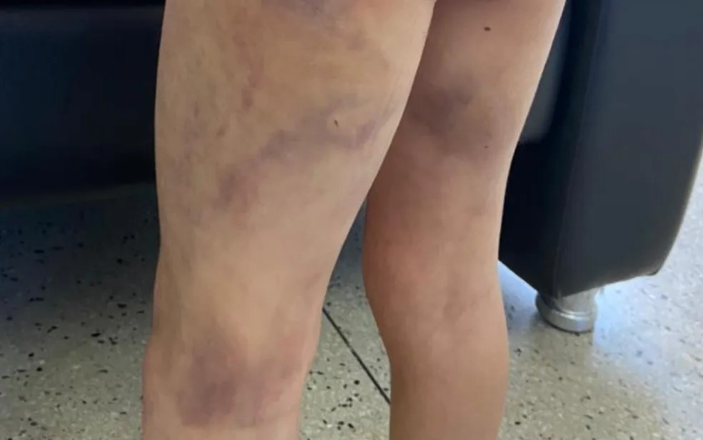 NO TANCREDO:  Mulher é agredida a mangueirada ao tentar buscar objetos na casa do ex-marido 