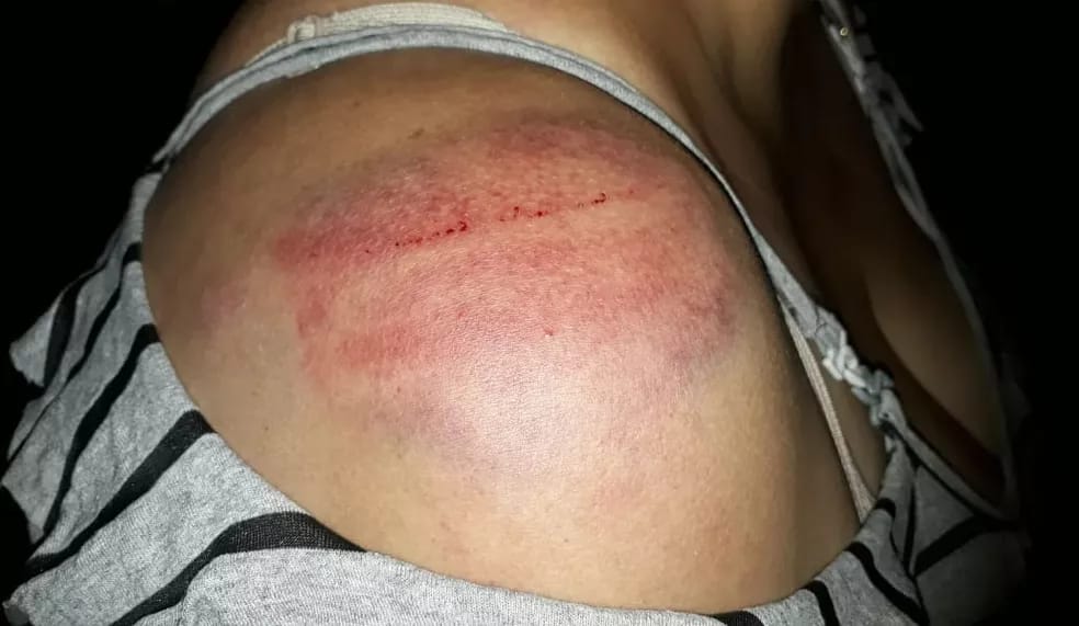 COVARDIA: Esposa é socorrida para a UPA após ser brutalmente agredida pelo marido