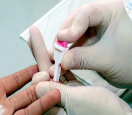 Rondônia comemora redução nos casos de Aids em 2017