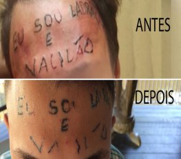 Internado, jovem tatuado na testa diz: 'Hoje, olho no espelho'