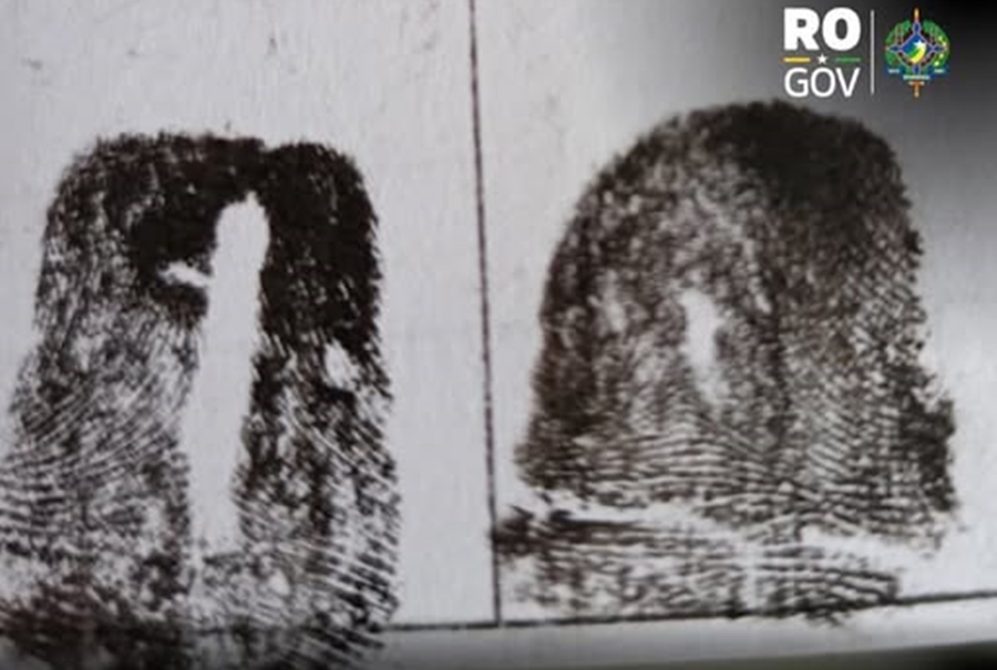 TÉCNICA ESPECIALIZADA: Polícia Civil identifica cadáver em avançado estado de decomposição