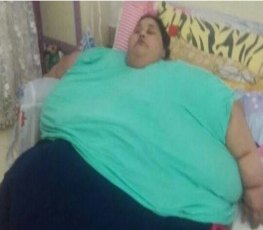 Mulher com 495kg é tirada com guindaste e levada por avião cargueiro