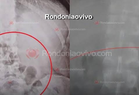 URGENTE: Mãe é flagrada levando drogas para o filho no presídio 603