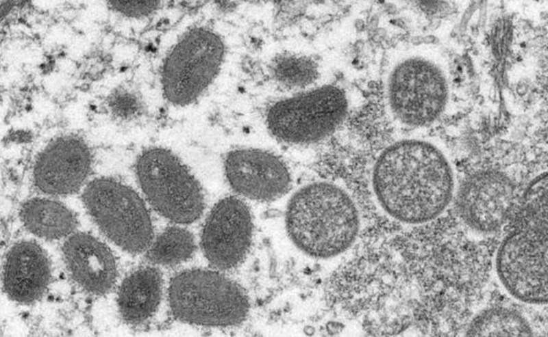 ALERTA:  País tem sete casos de varíola dos macacos e outros nove em investigação