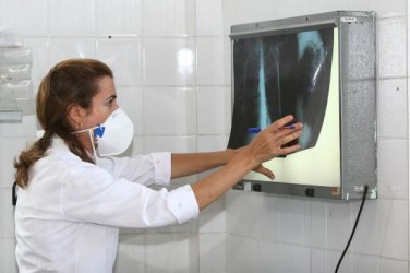 Anvisa aprova registro de novo medicamento para tuberculose