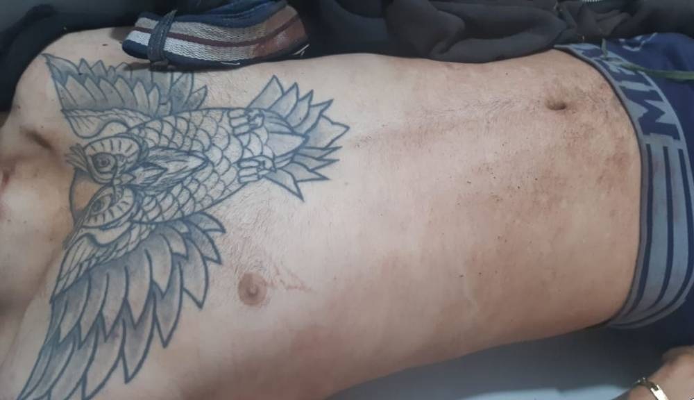 MISTÉRIO: Polícia tenta identificar corpo tatuado de rapaz morto a pauladas