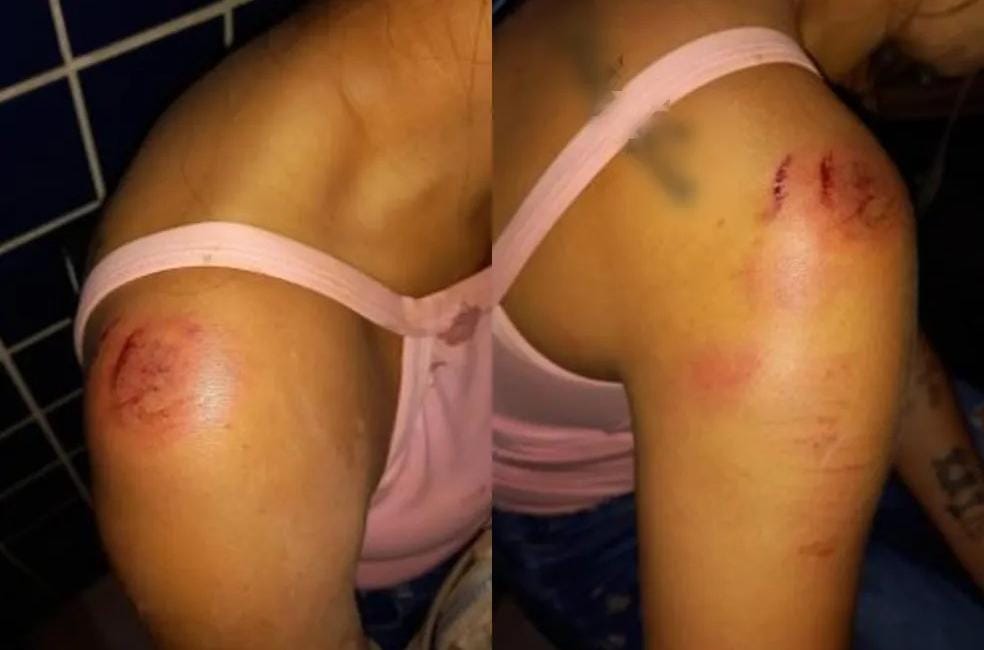 CRISTAL DA CALAMA: Mulher é espancada após descobrir traição no celular do marido 