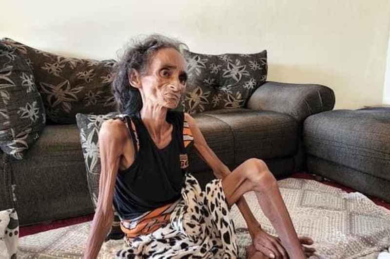 TRISTEZA: Morre idosa que não tinha documentos e lutava por tratamento de câncer 