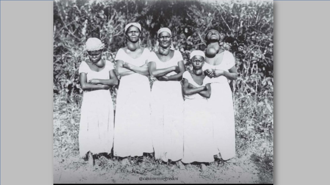 IODO NO CORPO: O dia em o que o sal virou um santo remédio 