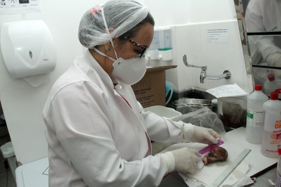 SAÚDE´: Laboratório prioriza casos suspeitos de câncer e agiliza os diagnósticos