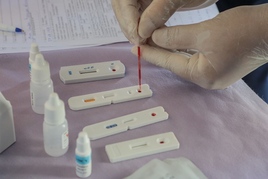 DEZEMBRO VERMELHO: Mês de combate ao HIV reforça a necessidade de testagem periódica 