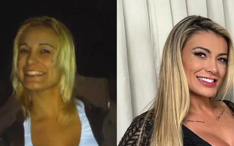 SURPREENDENTE: Viraliza vídeo mostrando antes e depois de Andressa Urach