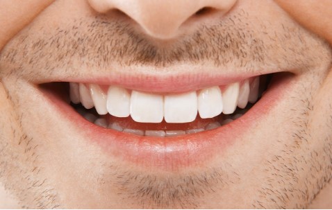 Dentes brancos? Clareador dental que revolucionou o Brasil