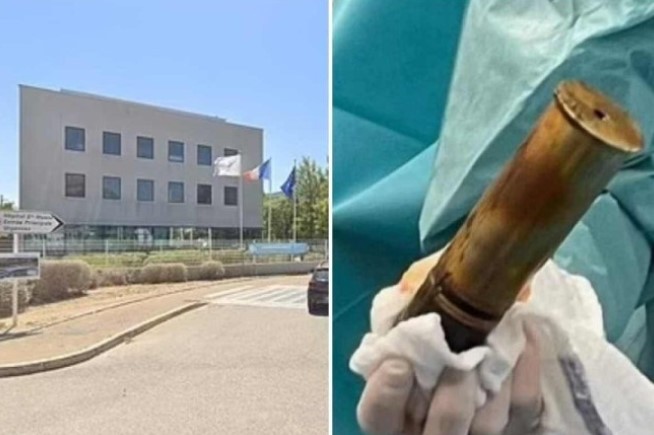 MEDO DE EXPLOSÃO: Homem dá entrada em hospital com bomba no ânus e apavora médicos