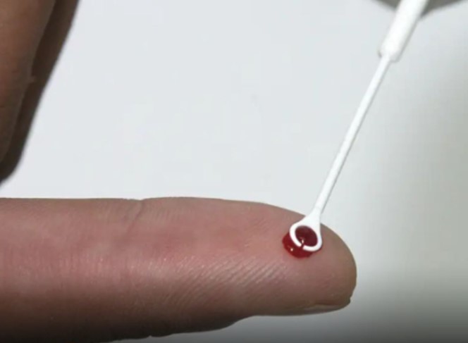 QUASE VACINA: Novo medicamento contra AIDS tem alta eficácia comprovada