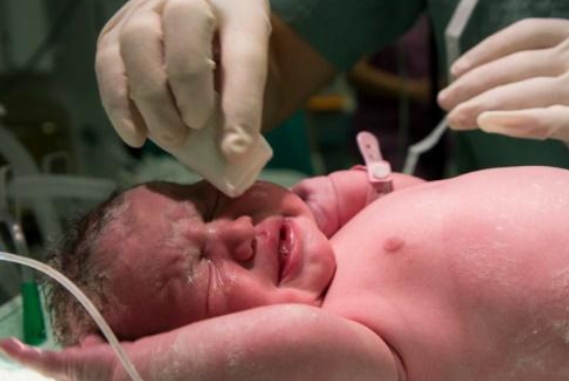 ALÍVIO: Inteligência artificial ajuda a identificar dor em recém-nascidos em UTIs