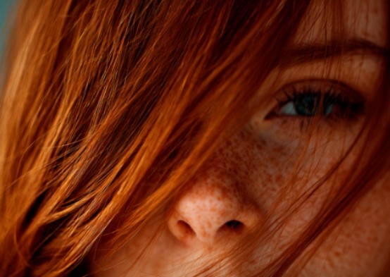 CIENTISTAS AFIRMAM: Pessoas ruivas sentem dor de forma diferente e tem mais prazer