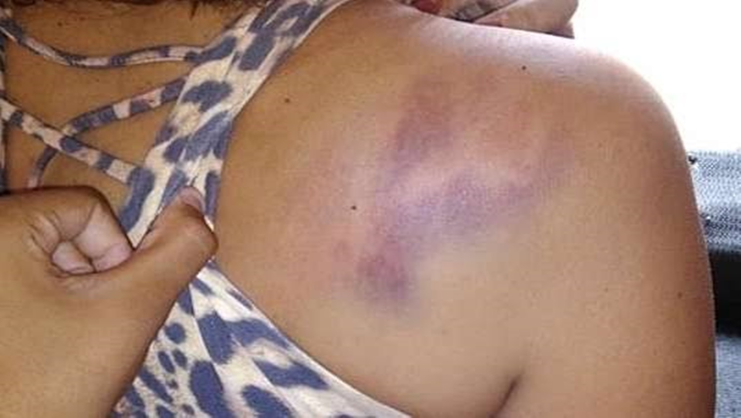 ENCIUMADO: Mulher é espancada pelo marido após beber na casa dos primos