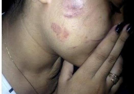 DESDE A MADRUGADA: Garota é agredida e mantida em cárcere privado pelo marido em apartamento
