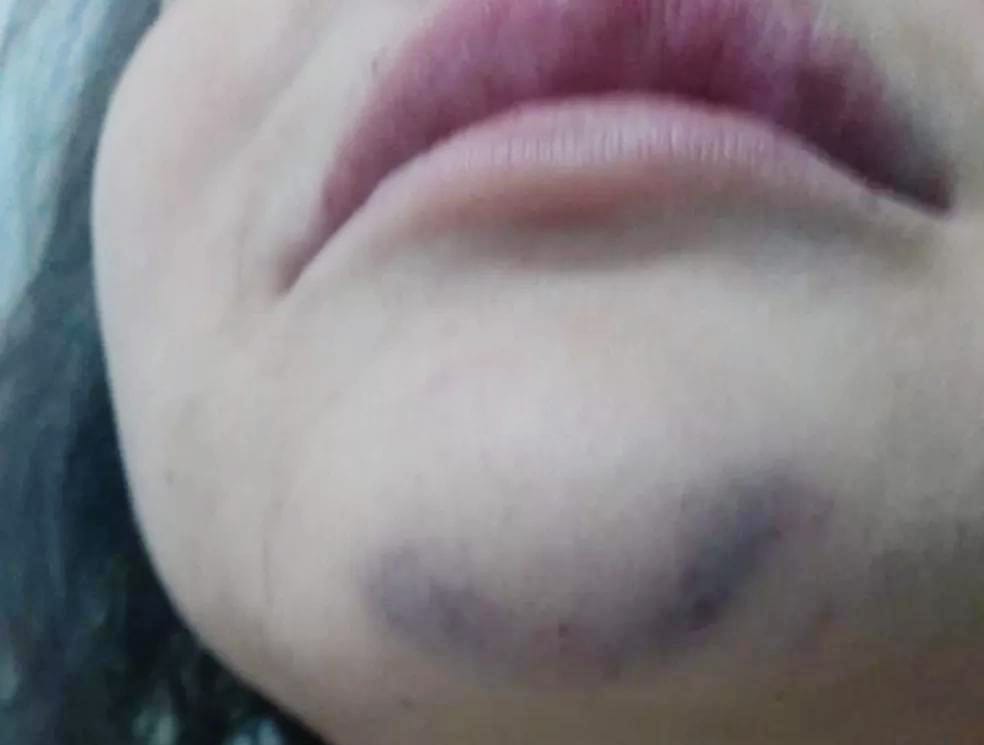 SEM PIEDADE: Mãe é agredida com socos no rosto pelo filho por causa de certidão de nascimento