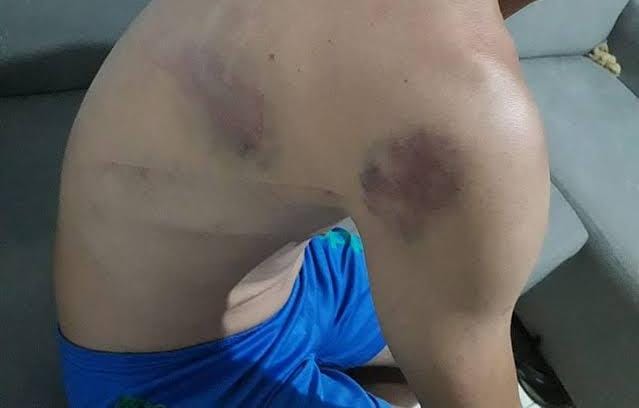 INCONFORMADA: Mulher invade residência e ataca ex-namorado a capacetadas 
