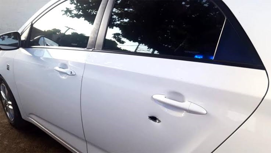 SE LIVROU: Motorista escapa da morte após tiro acertar boné em tentativa de assassinato 
