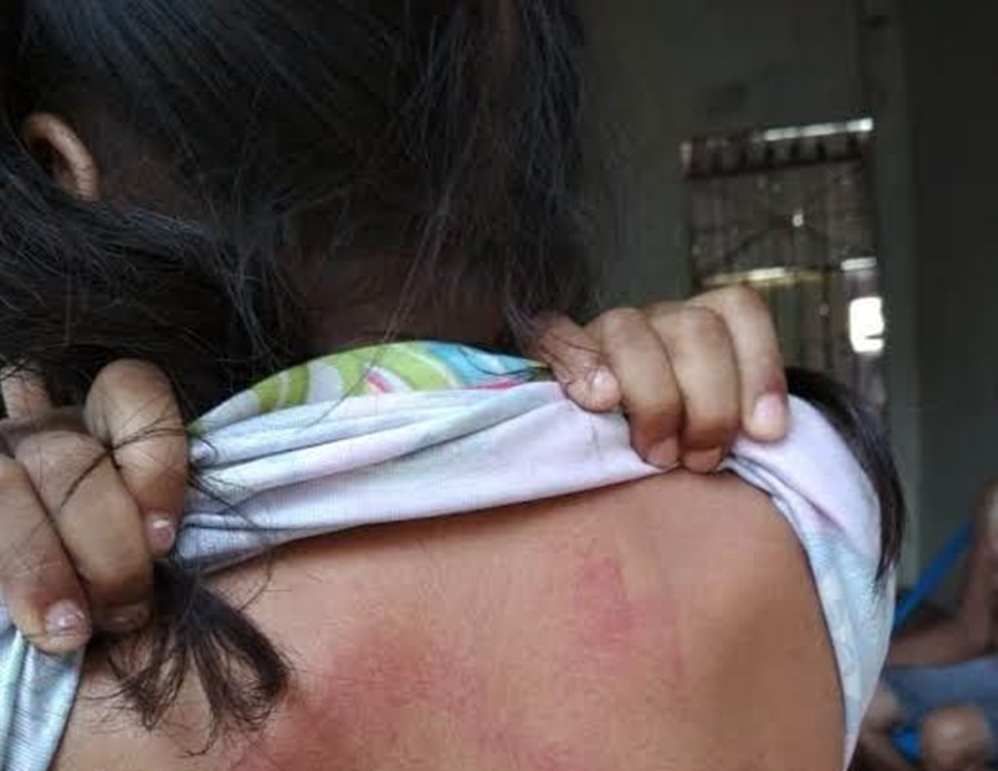 COVARDIA: Após expulsar marido de casa, mulher e a filha de 10 anos são agredidas