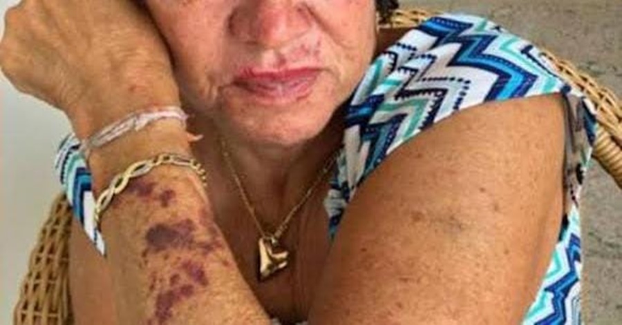 ABSURDO: Idosa de 71 anos é espancada pelo filho por não gostar da nora