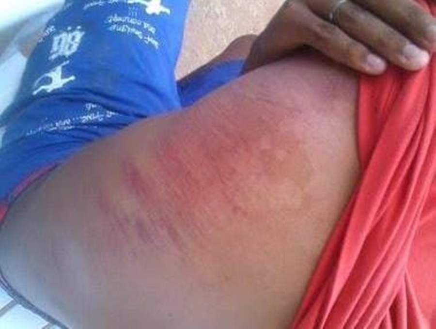 COVARDIA: Garoto de 14 anos é espancado por bandidos durante assalto 