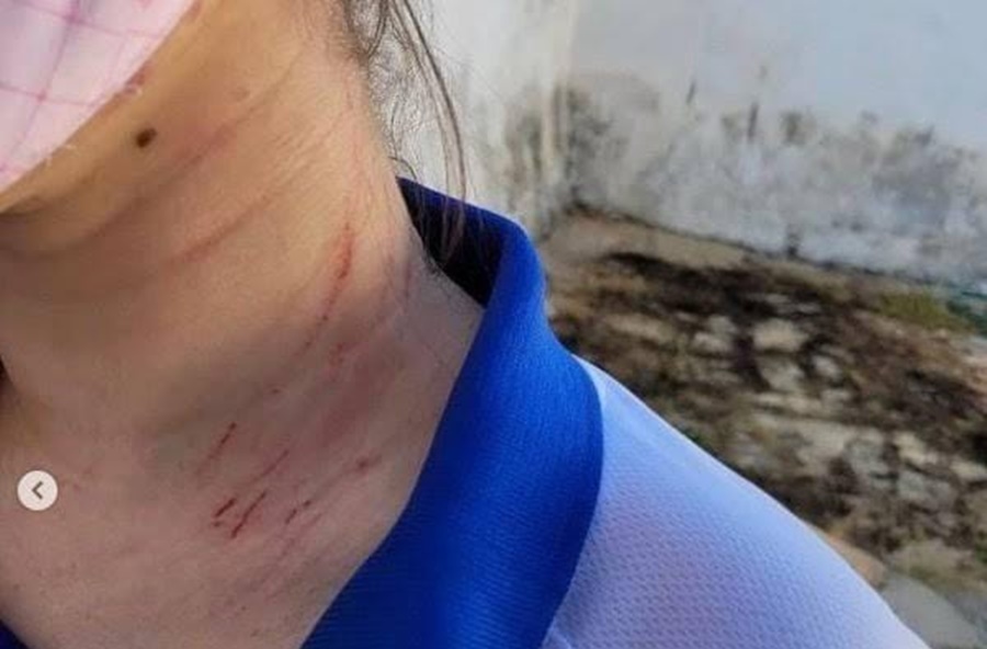 'CRISE DE CIÚMES': Garota de 15 anos é socorrida para a UPA após ser atacada pelo marido de 37