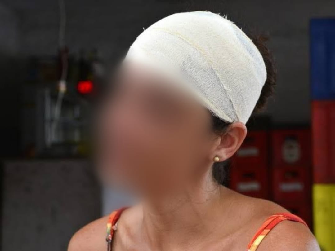 EMBRIAGADO: Mulher é socorrida às pressas após ser atacada na cabeça pelo marido