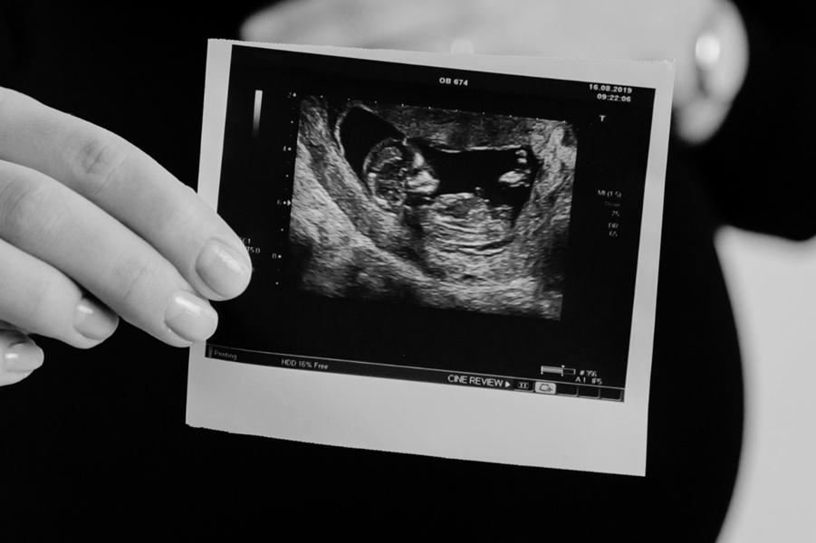 POLÊMICO: Câmara pauta urgência de projeto que equipara aborto ao homicídio