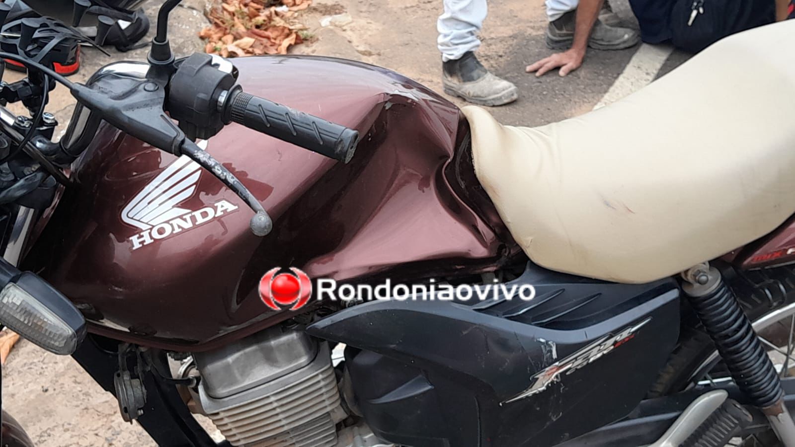 URGENTE: Idoso tem gravíssima fratura exposta na perna após colisão entre motos na Abunã 