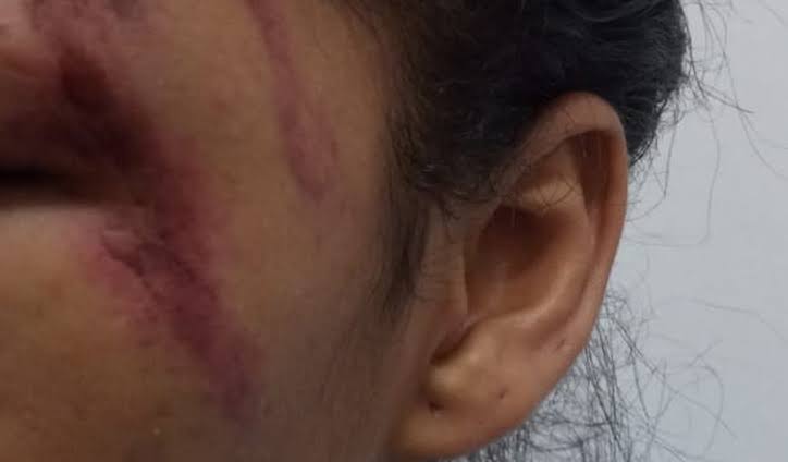 DENTRO DE CASA: Mulher é brutalmente agredida  pelo marido durante bebedeira em residência 