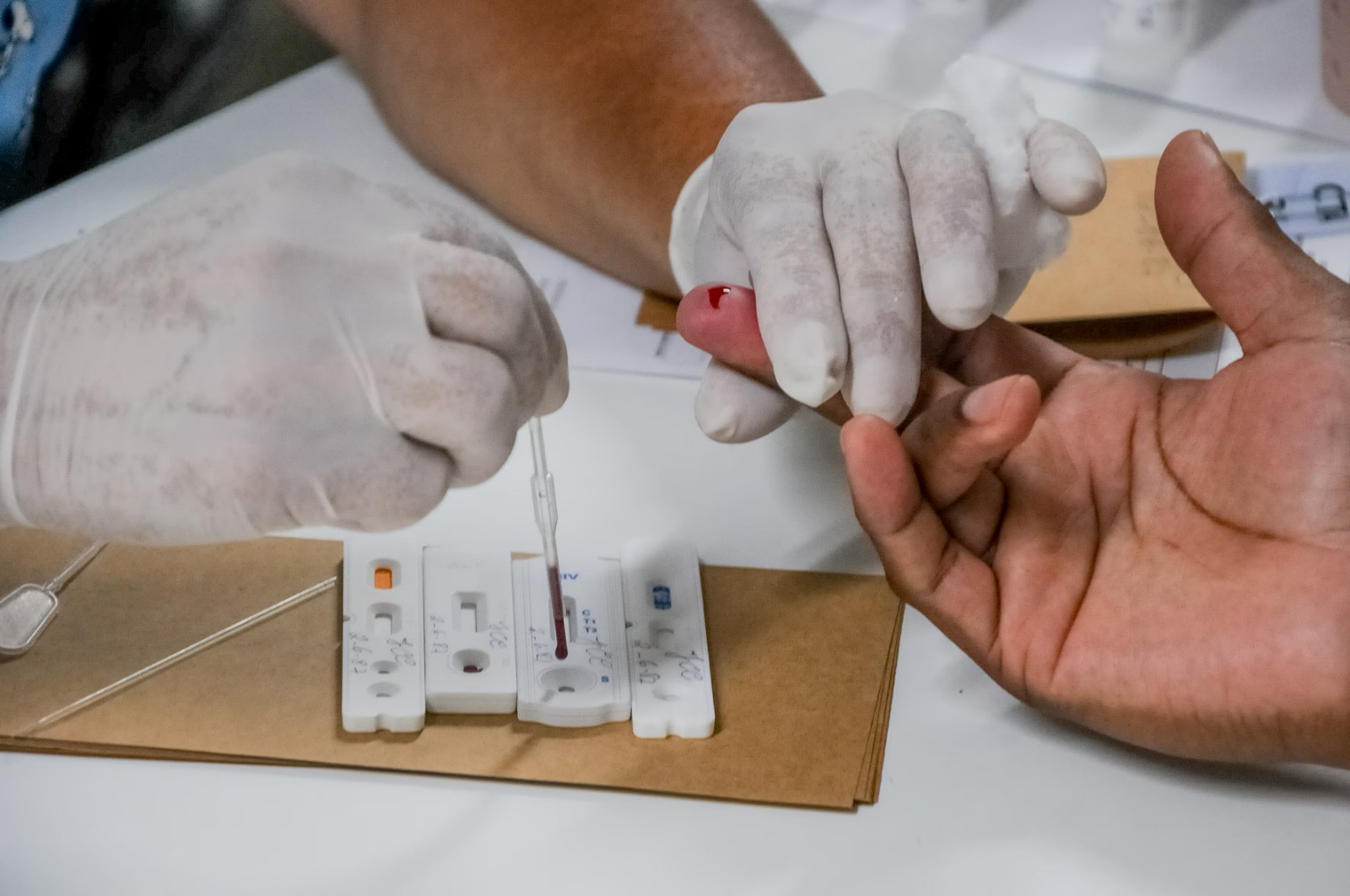 JULHO AMARELO: Ministério da Saúde vai realizar testagem inédita da hepatite D em Rondônia