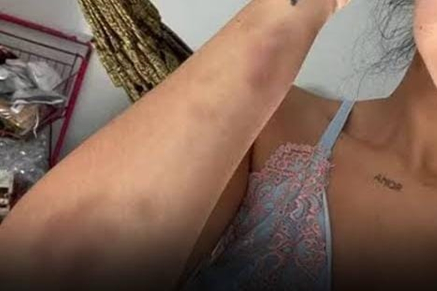 CIÚMES: Mulher chama namorado para festa e acaba espancada após encontrar o ex 