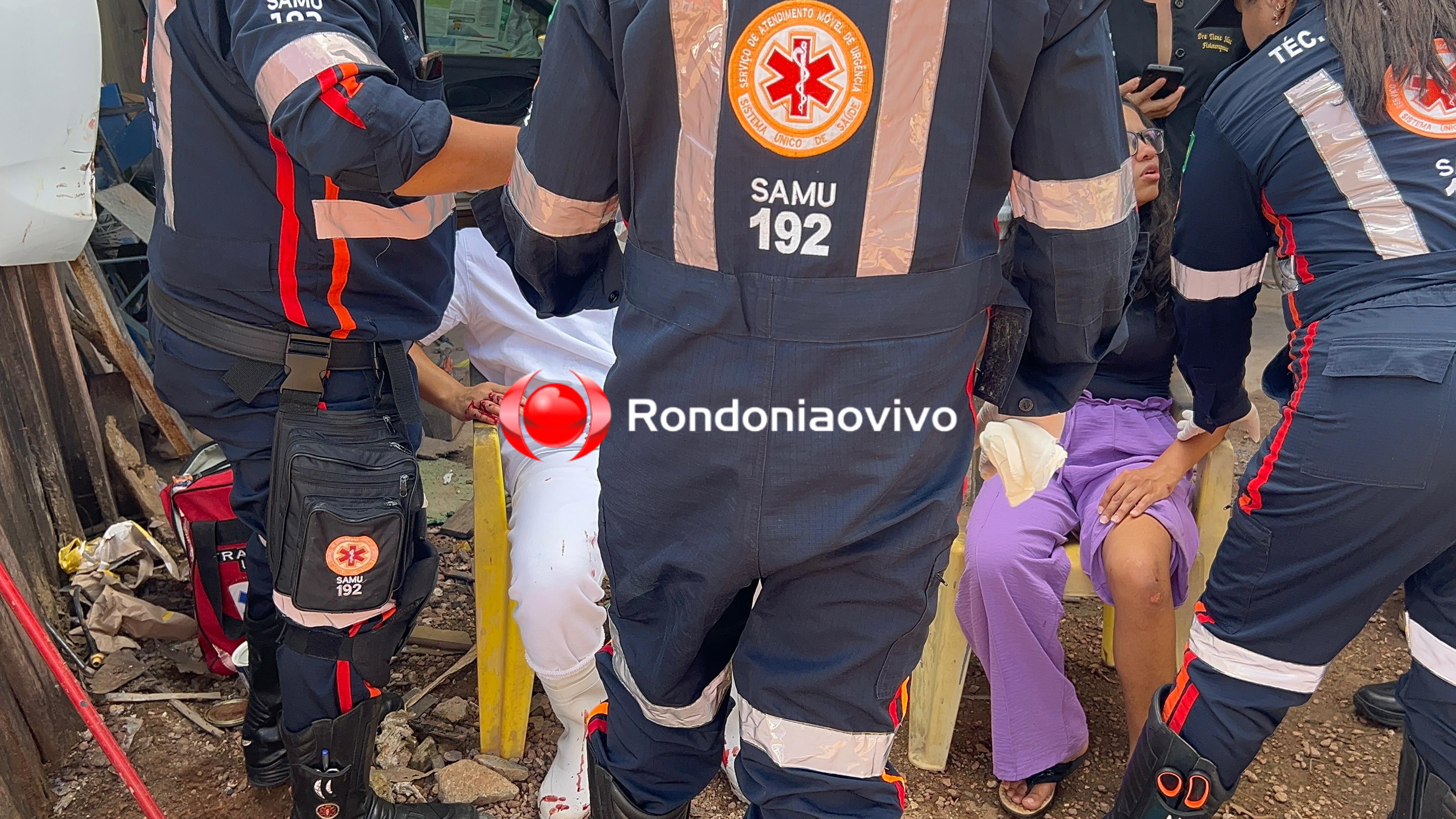 VÍDEO: Motociclista fica com fratura exposta em grave acidente