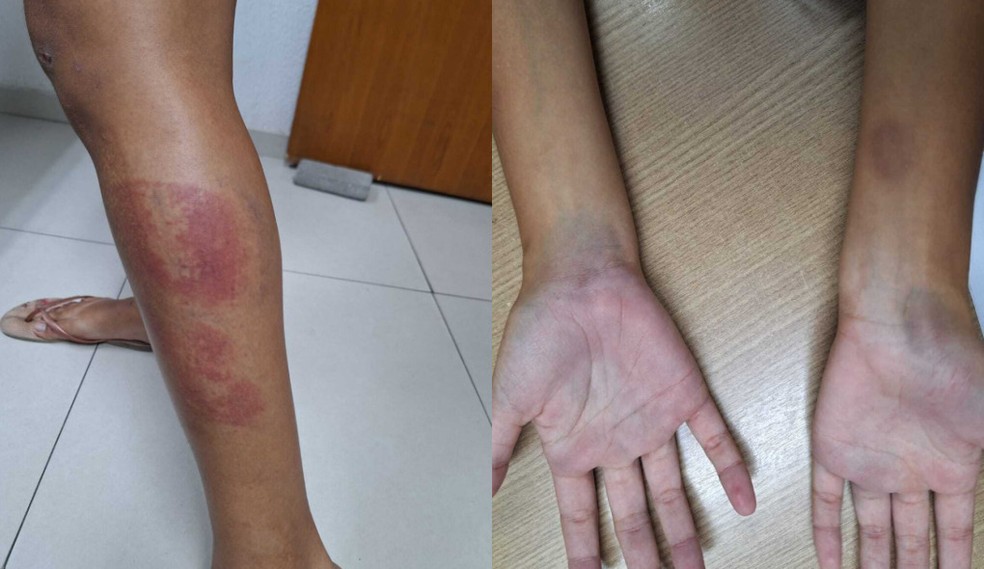 COVARDIA: Esposa é agredida a pauladas pelo marido; 'Ela não deu alimentação aos filhos' 