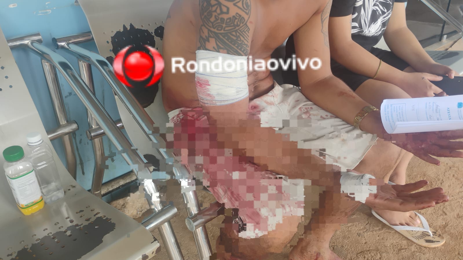 URGENTE: Marido é atacado pela esposa durante bebedeira em residência 