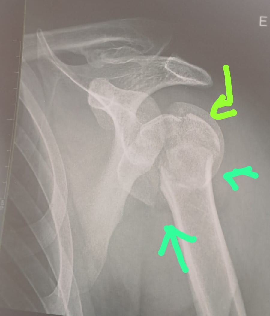 SAÚDE PÚBLICA: 'Isso é um descaso', diz pai de jovem internado no Hospital de Base