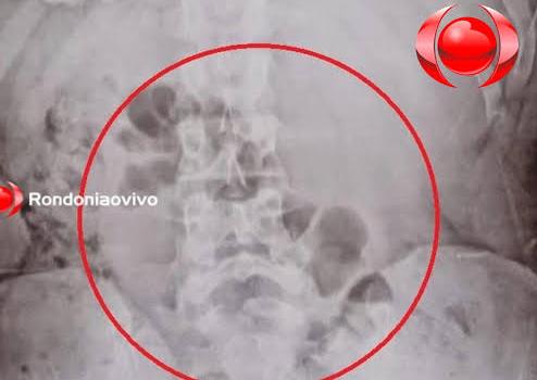 VIROU ROTINA: Mais uma mulher é presa ao tentar entrar com droga no presídio '603' 